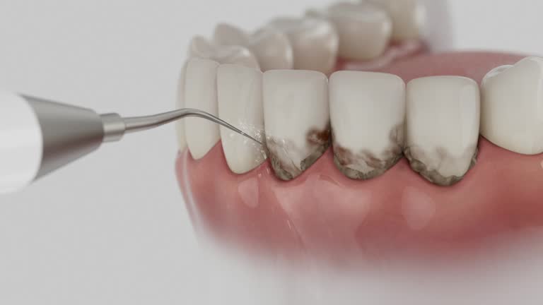 Reliable Dental contractor in Lamar, AR by Smile Center Dentistry